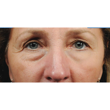 Elicina, ECO XT Eye Contour