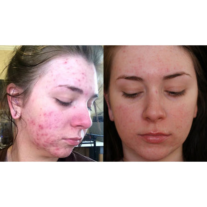 Elicina, Face Cream