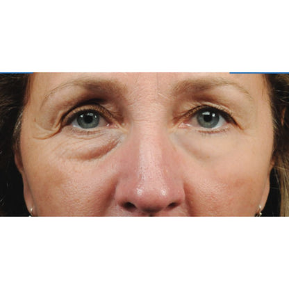 Elicina, ECO XT Eye Contour