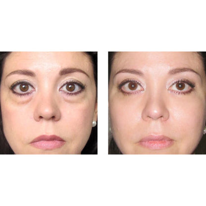 Elicina, ECO XT Eye Contour