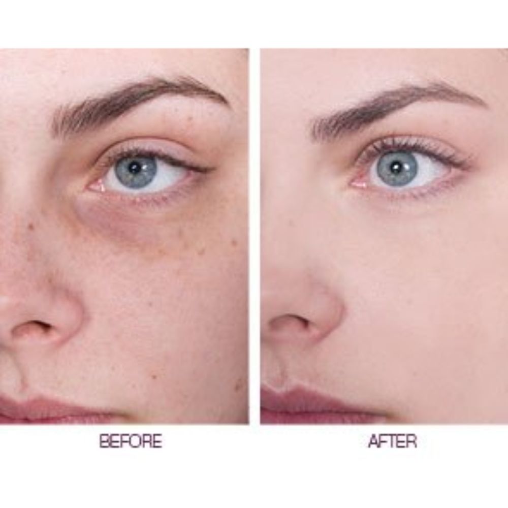 Elicina, ECO XT Eye Contour