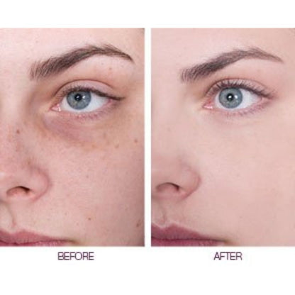 Elicina, ECO XT Eye Contour